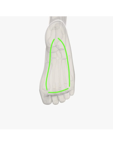 Orthopedic Insole 5-Bar